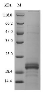 SDS-PAGE- Recombinant protein Human ZG16B