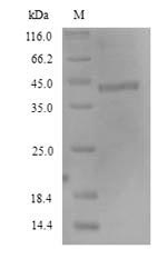 (Tris-Glycine gel) Discontinuous SDS-PAGE (reduced) with 5% enrichment gel and 15% separation gel. (Tris-Glycine gel) Discontinuous SDS-PAGE (reduced) with 5% enrichment gel and 15% separation gel.