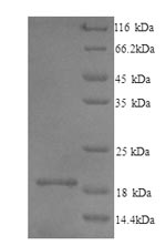 (Tris-Glycine gel) Discontinuous SDS-PAGE (reduced) with 5% enrichment gel and 15% separation gel. (Tris-Glycine gel) Discontinuous SDS-PAGE (reduced) with 5% enrichment gel and 15% separation gel.