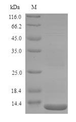 (Tris-Glycine gel) Discontinuous SDS-PAGE (reduced) with 5% enrichment gel and 15% separation gel. (Tris-Glycine gel) Discontinuous SDS-PAGE (reduced) with 5% enrichment gel and 15% separation gel.