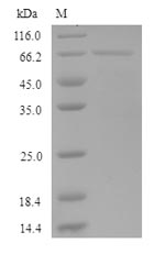 (Tris-Glycine gel) Discontinuous SDS-PAGE (reduced) with 5% enrichment gel and 15% separation gel. (Tris-Glycine gel) Discontinuous SDS-PAGE (reduced) with 5% enrichment gel and 15% separation gel.