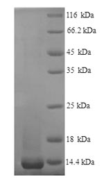 (Tris-Glycine gel) Discontinuous SDS-PAGE (reduced) with 5% enrichment gel and 15% separation gel. (Tris-Glycine gel) Discontinuous SDS-PAGE (reduced) with 5% enrichment gel and 15% separation gel.