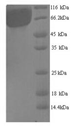 (Tris-Glycine gel) Discontinuous SDS-PAGE (reduced) with 5% enrichment gel and 15% separation gel. (Tris-Glycine gel) Discontinuous SDS-PAGE (reduced) with 5% enrichment gel and 15% separation gel.