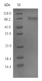 (Tris-Glycine gel) Discontinuous SDS-PAGE (reduced) with 5% enrichment gel and 15% separation gel. (Tris-Glycine gel) Discontinuous SDS-PAGE (reduced) with 5% enrichment gel and 15% separation gel.