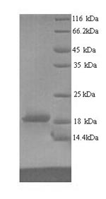(Tris-Glycine gel) Discontinuous SDS-PAGE (reduced) with 5% enrichment gel and 15% separation gel. (Tris-Glycine gel) Discontinuous SDS-PAGE (reduced) with 5% enrichment gel and 15% separation gel.