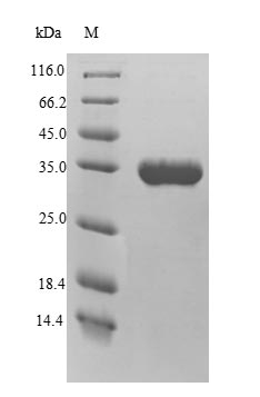(Tris-Glycine gel) Discontinuous SDS-PAGE (reduced) with 5% enrichment gel and 15% separation gel. (Tris-Glycine gel) Discontinuous SDS-PAGE (reduced) with 5% enrichment gel and 15% separation gel.