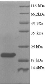 (Tris-Glycine gel) Discontinuous SDS-PAGE (reduced) with 5% enrichment gel and 15% separation gel. (Tris-Glycine gel) Discontinuous SDS-PAGE (reduced) with 5% enrichment gel and 15% separation gel.