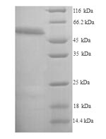 (Tris-Glycine gel) Discontinuous SDS-PAGE (reduced) with 5% enrichment gel and 15% separation gel. (Tris-Glycine gel) Discontinuous SDS-PAGE (reduced) with 5% enrichment gel and 15% separation gel.