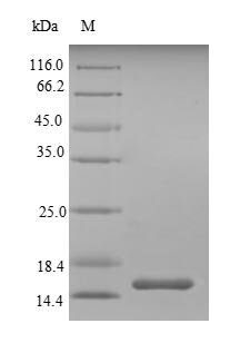 (Tris-Glycine gel) Discontinuous SDS-PAGE (reduced) with 5% enrichment gel and 15% separation gel. (Tris-Glycine gel) Discontinuous SDS-PAGE (reduced) with 5% enrichment gel and 15% separation gel.