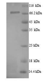 (Tris-Glycine gel) Discontinuous SDS-PAGE (reduced) with 5% enrichment gel and 15% separation gel. (Tris-Glycine gel) Discontinuous SDS-PAGE (reduced) with 5% enrichment gel and 15% separation gel.