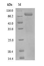 (Tris-Glycine gel) Discontinuous SDS-PAGE (reduced) with 5% enrichment gel and 15% separation gel. (Tris-Glycine gel) Discontinuous SDS-PAGE (reduced) with 5% enrichment gel and 15% separation gel.
