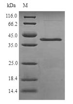 (Tris-Glycine gel) Discontinuous SDS-PAGE (reduced) with 5% enrichment gel and 15% separation gel.