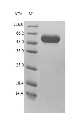 (Tris-Glycine gel) Discontinuous SDS-PAGE (reduced) with 5% enrichment gel and 15% separation gel. (Tris-Glycine gel) Discontinuous SDS-PAGE (reduced) with 5% enrichment gel and 15% separation gel.