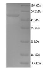 SDS-PAGE- Recombinant protein Human FBXO3