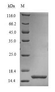 (Tris-Glycine gel) Discontinuous SDS-PAGE (reduced) with 5% enrichment gel and 15% separation gel. (Tris-Glycine gel) Discontinuous SDS-PAGE (reduced) with 5% enrichment gel and 15% separation gel.