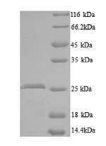 SDS-PAGE- Recombinant protein Mouse Wisp2