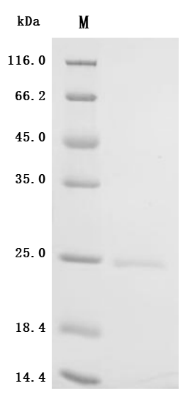 Recombinant Human Sodium-dependent phosphate transport protein 2B (SLC34A2) , partial - image 1