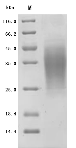 (Tris-Glycine gel) Discontinuous SDS-PAGE (reduced) with 5% enrichment gel and 15% separation gel.