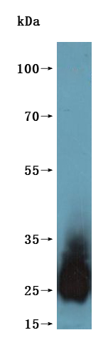 CSB-MP025166HU is detected by Mouse anti-6*His monoclonal antibody.(This tag can be tested only under denaturing conditions.)