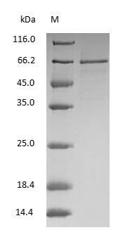 (Tris-Glycine gel) Discontinuous SDS-PAGE (reduced) with 5% enrichment gel and 15% separation gel. (Tris-Glycine gel) Discontinuous SDS-PAGE (reduced) with 5% enrichment gel and 15% separation gel.