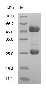 (Tris-Glycine gel) Discontinuous SDS-PAGE (reduced) with 5% enrichment gel and 15% separation gel.