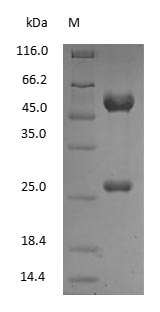 (Tris-Glycine gel) Discontinuous SDS-PAGE (reduced) with 5% enrichment gel and 15% separation gel. (Tris-Glycine gel) Discontinuous SDS-PAGE (reduced) with 5% enrichment gel and 15% separation gel.