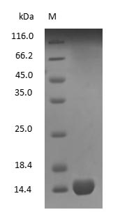 (Tris-Glycine gel) Discontinuous SDS-PAGE (reduced) with 5% enrichment gel and 15% separation gel. (Tris-Glycine gel) Discontinuous SDS-PAGE (reduced) with 5% enrichment gel and 15% separation gel.