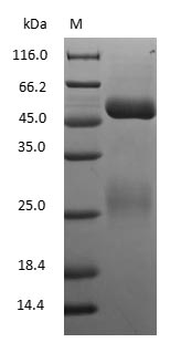 (Tris-Glycine gel) Discontinuous SDS-PAGE (reduced) with 5% enrichment gel and 15% separation gel.