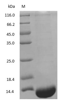 (Tris-Glycine gel) Discontinuous SDS-PAGE (reduced) with 5% enrichment gel and 15% separation gel.