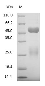 (Tris-Glycine gel) Discontinuous SDS-PAGE (reduced) with 5% enrichment gel and 15% separation gel.