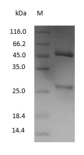 (Tris-Glycine gel) Discontinuous SDS-PAGE (reduced) with 5% enrichment gel and 15% separation gel.