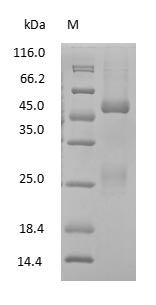 (Tris-Glycine gel) Discontinuous SDS-PAGE (reduced) with 5% enrichment gel and 15% separation gel.
