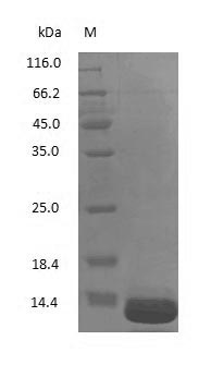 (Tris-Glycine gel) Discontinuous SDS-PAGE (reduced) with 5% enrichment gel and 15% separation gel. (Tris-Glycine gel) Discontinuous SDS-PAGE (reduced) with 5% enrichment gel and 15% separation gel.